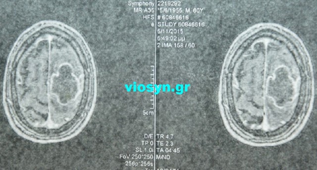 02g ap1a